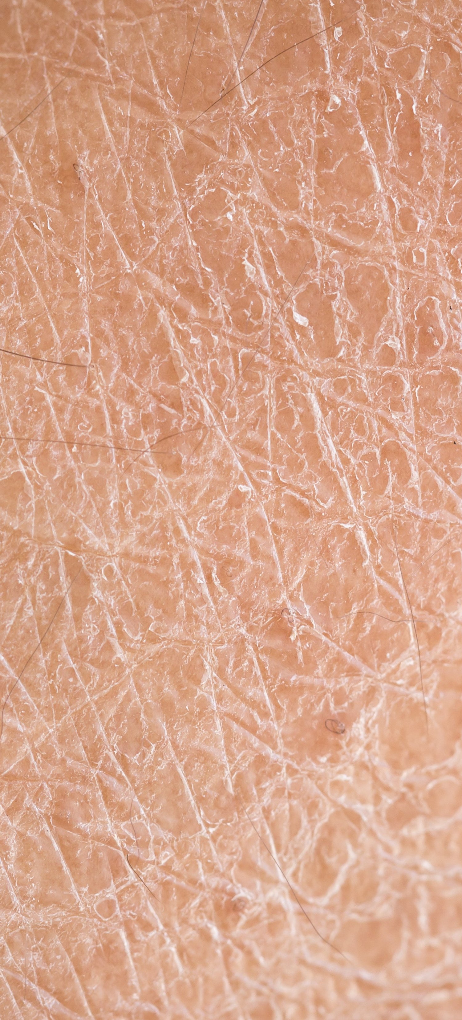 Trockene Haut - KLOTZ LABS Kosmetikmanufaktur