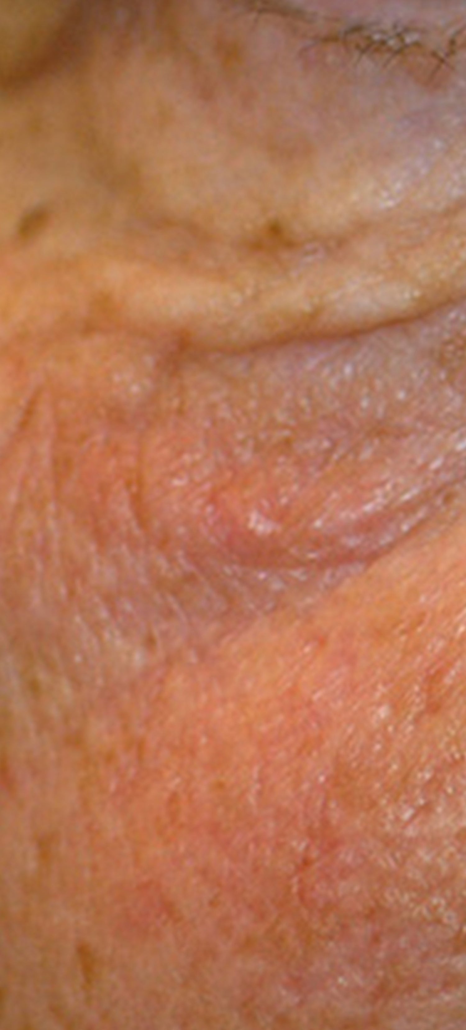 Schlaffe Haut - KLOTZ LABS Kosmetikmanufaktur